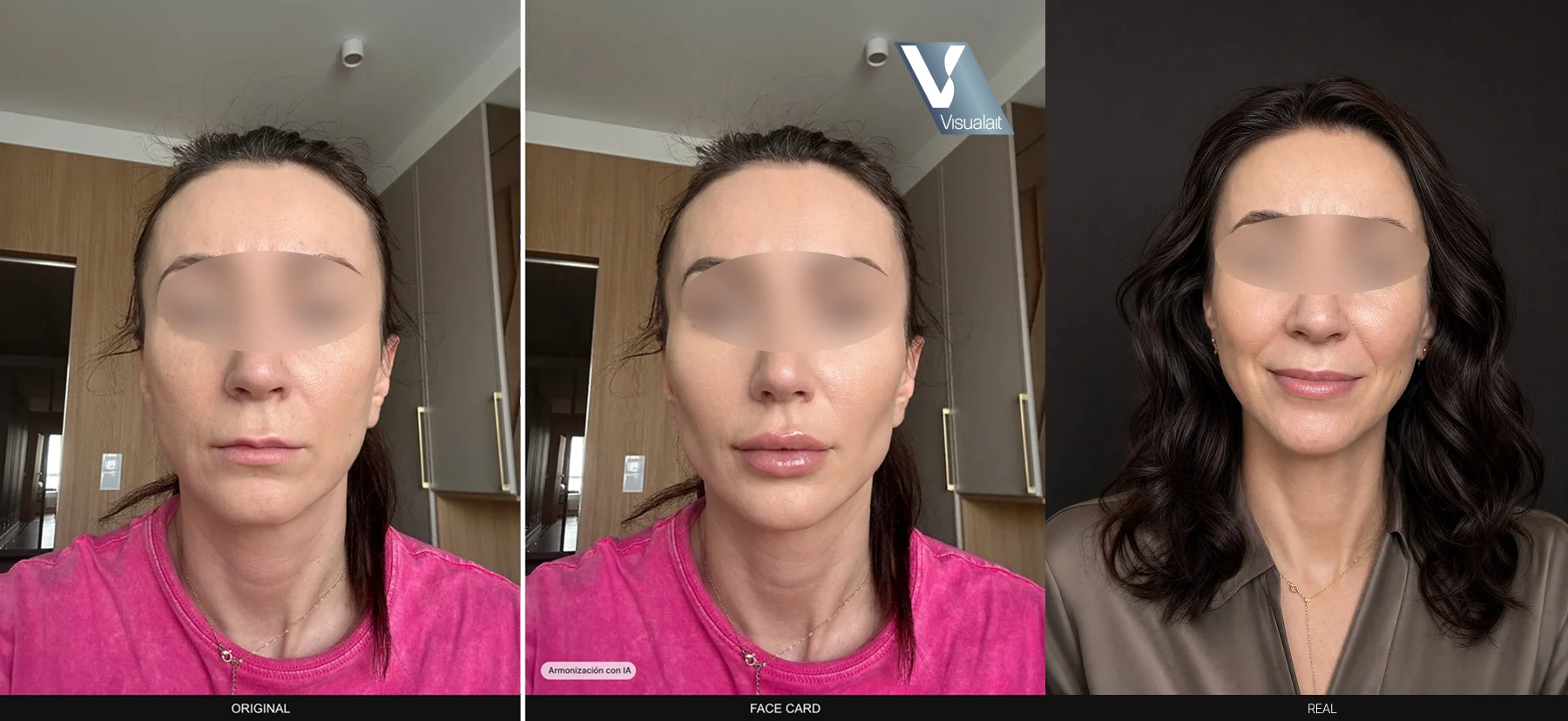Tres fotos de frente de la misma mujer: su cara original, la simulación de la armonización en estilo face card y el resultado real.