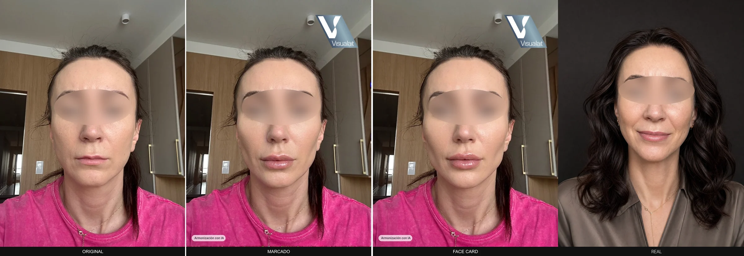 Zona de trabajo del simulador: armonización facial