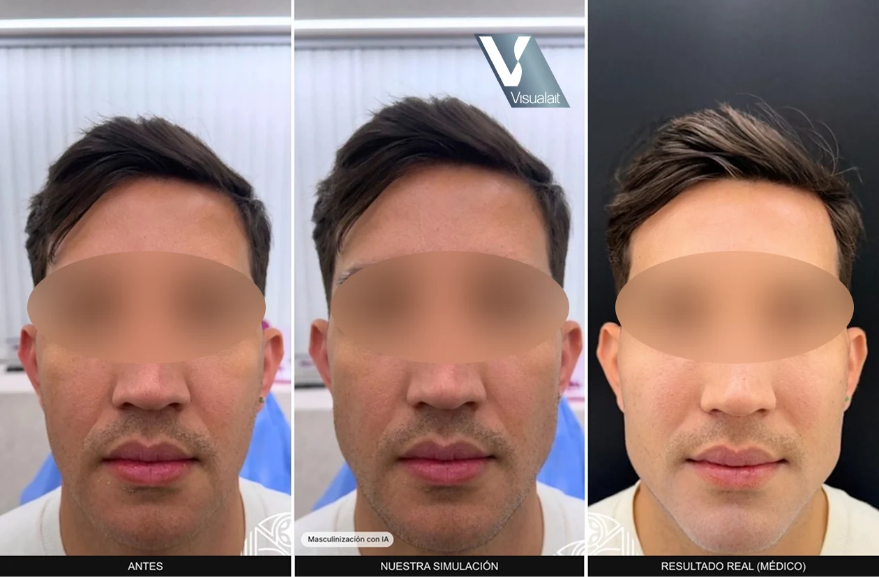 Zona de trabajo del simulador: masculinización facial